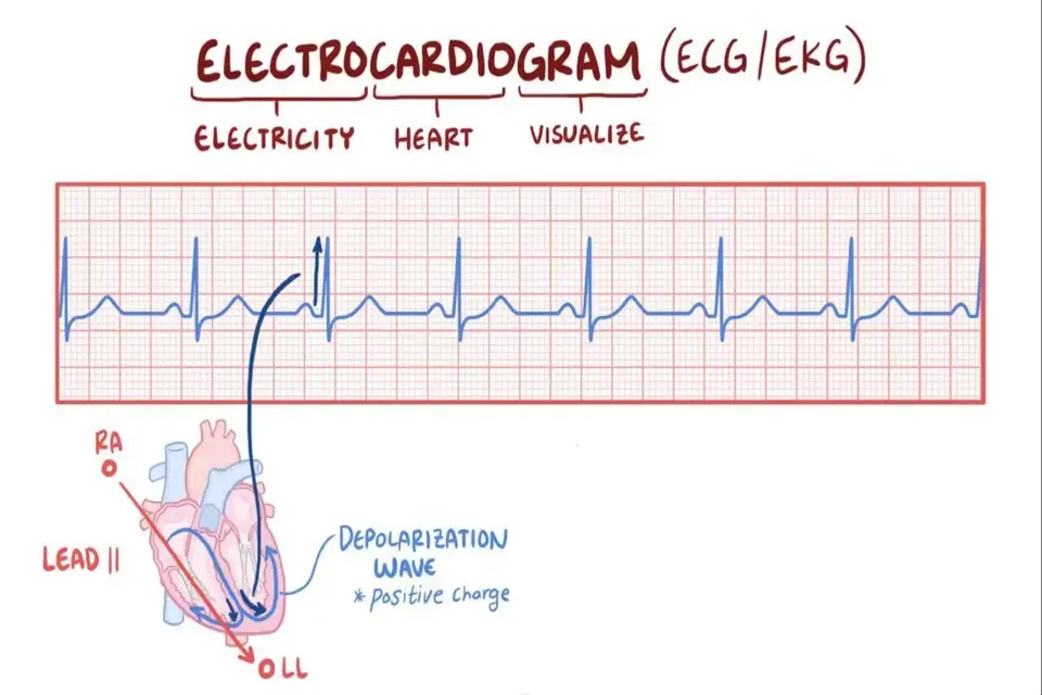 EKG Cihazı Kalbin Ritmini Kaydeden Teknoloji Harikası - 5